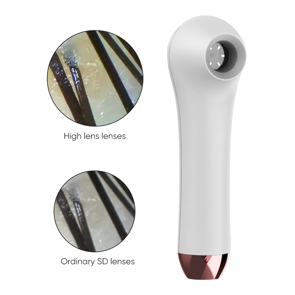 Domowy skaner skóry HD do derm – Hair Care Homemade recenzja i cena